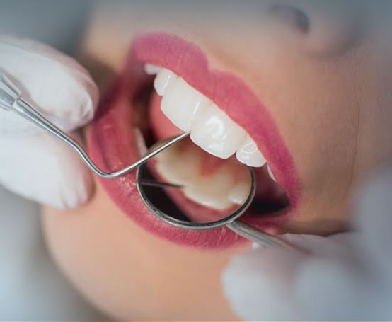 Ankara Beytepe Endodonti Kanal Tedavisi ve Güncel Fiyatları - Gürses Dental