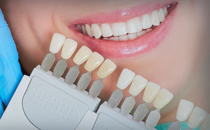 Ankara Beytepe Zirkonyum Diş Kaplama ve Tedavisi - Gürses Dental